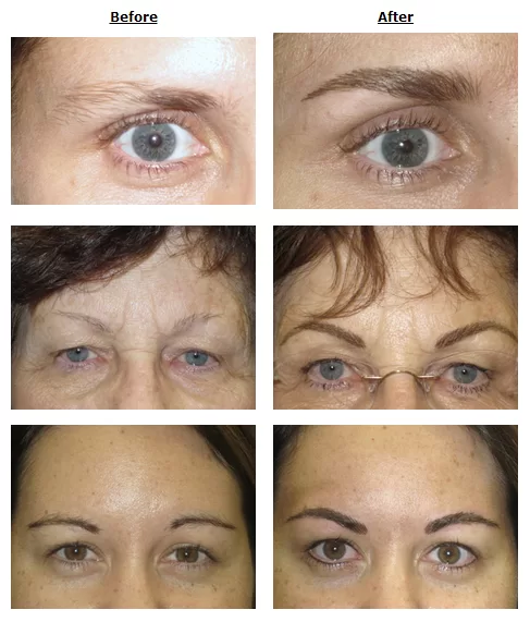 cosmetic_before_after Sherry's Drug Cosmetics